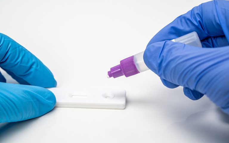 Mastering Indirect Immunofluorescence with HEp-2000 Slides