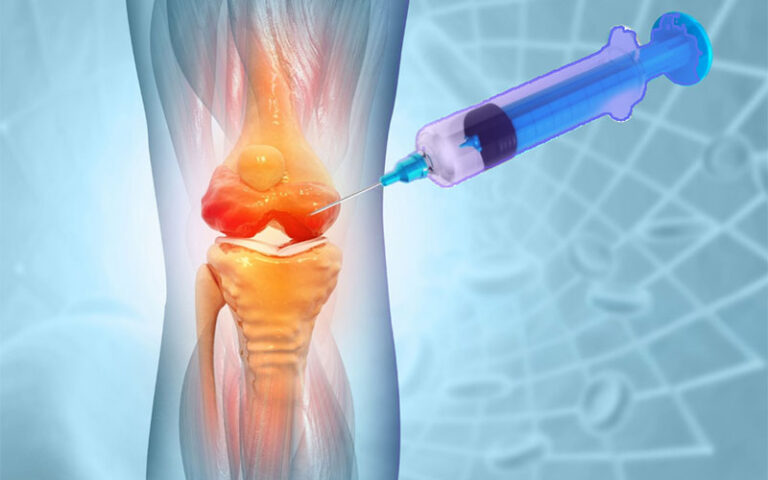 Foundation Level Course on Joint Injection Techniques